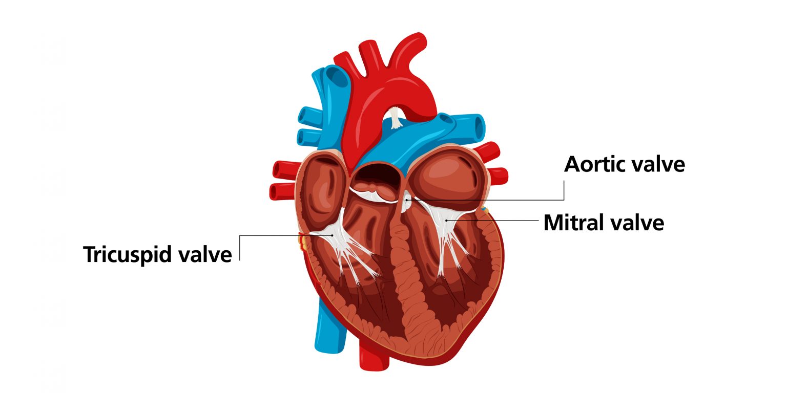 Transcatheter mitral valve repair (TMVr) - South Tees Hospitals NHS ...