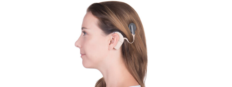 Adult rehabilitation, switch-on and tuning following cochlear ...