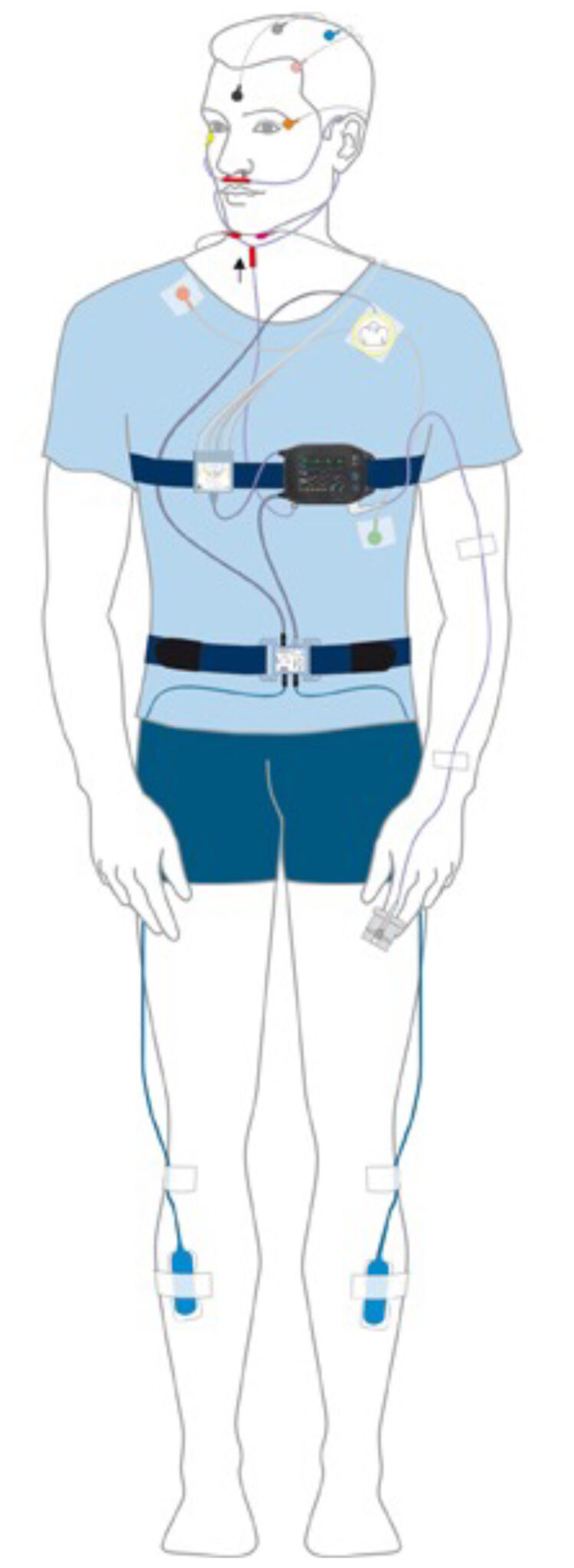 Polysomnography (PSG) and Multiple Sleep Latency (MSLT) sleep studies ...