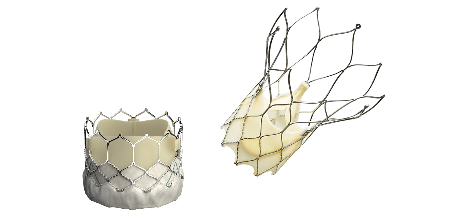 TAVI (Transcatheter Aortic Valve Implantation) - South Tees Hospitals ...