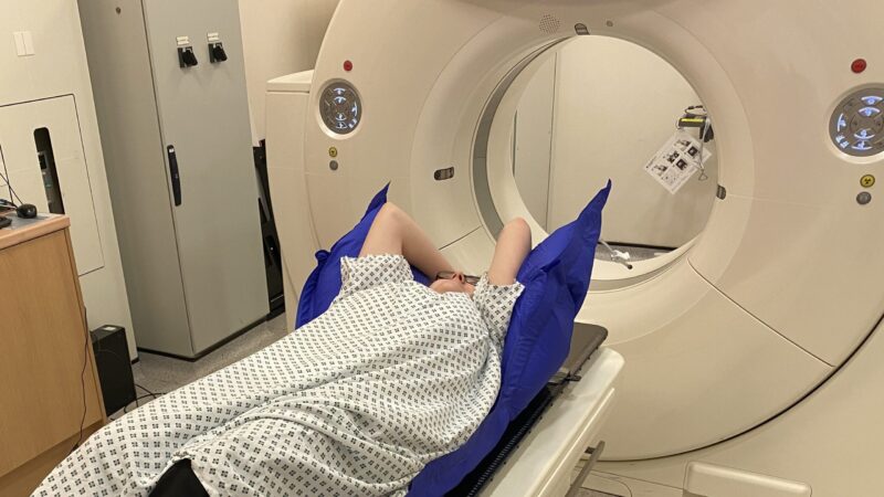 Patient lying on radiotherapy CT couch